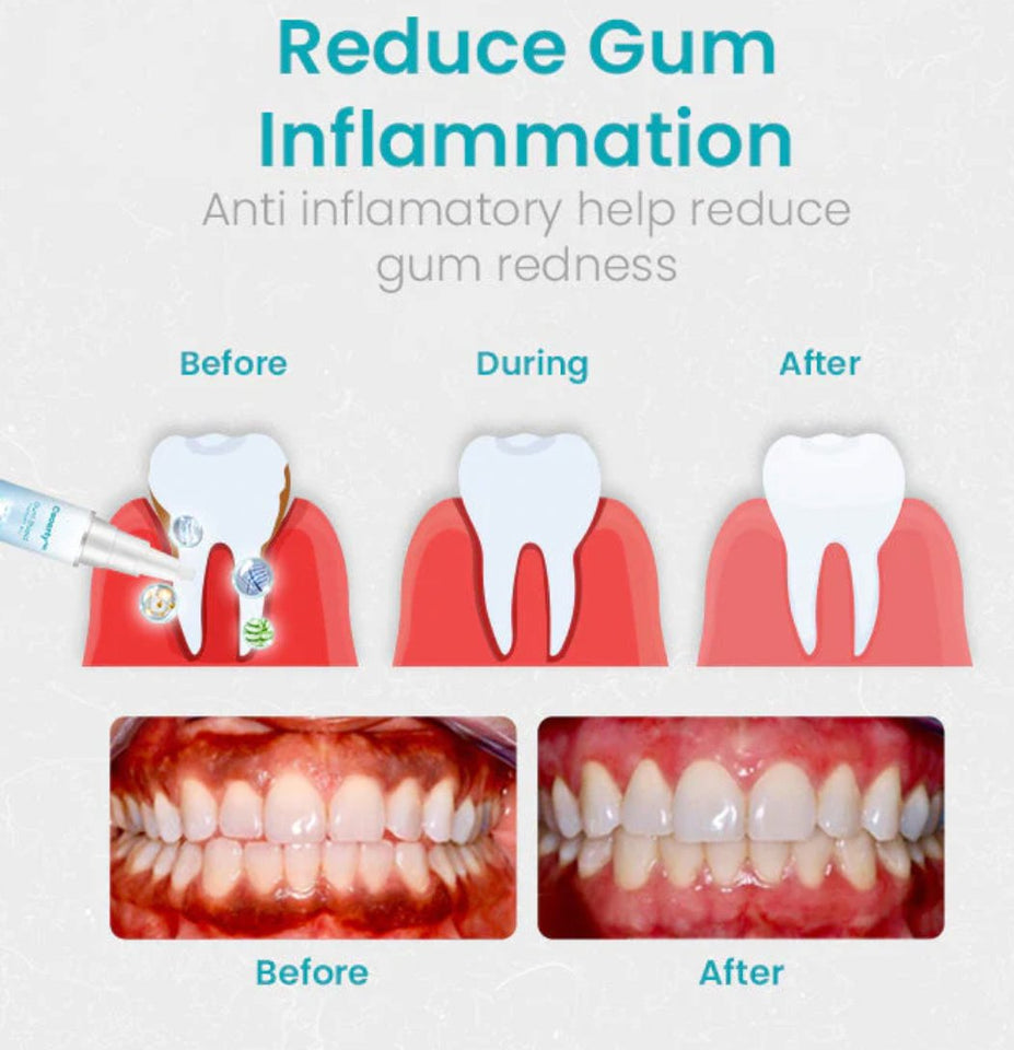 Ceoerty™ Gum Shield Therapy Gel - TumTum