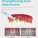 Ceoerty™ Gum Shield Therapy Gel - TumTum
