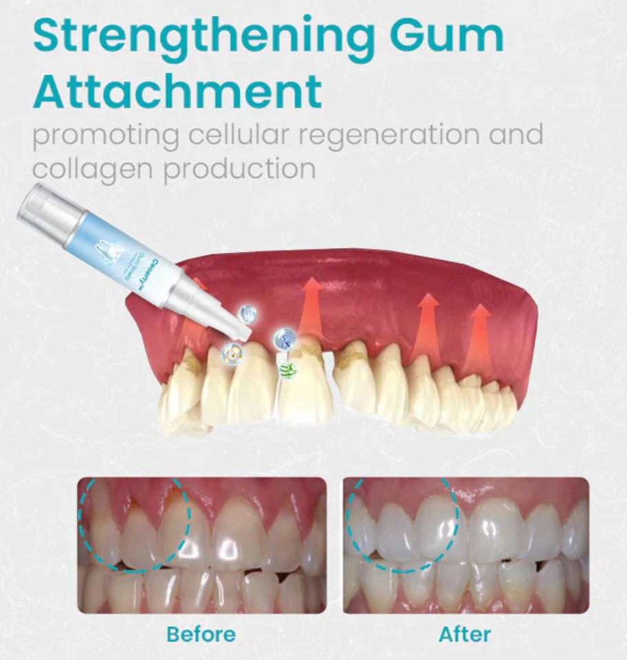 Ceoerty™ Gum Shield Therapy Gel - TumTum