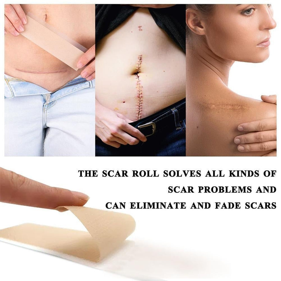 ELAIMEI™ Medical Soft Silicone Gel Tape for Scar Removal (1.6” x 60”） - TumTum