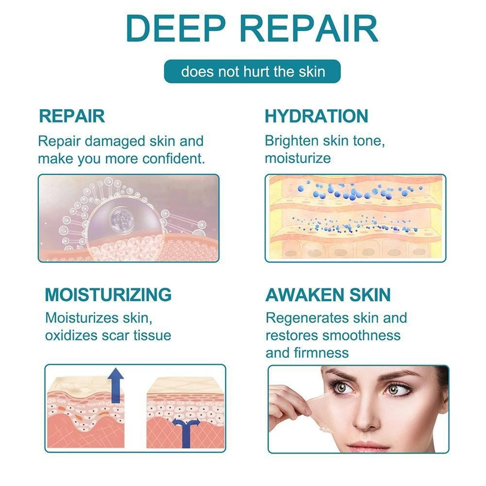 ELAIMEI™ Medical Soft Silicone Gel Tape for Scar Removal (1.6” x 60”） - TumTum