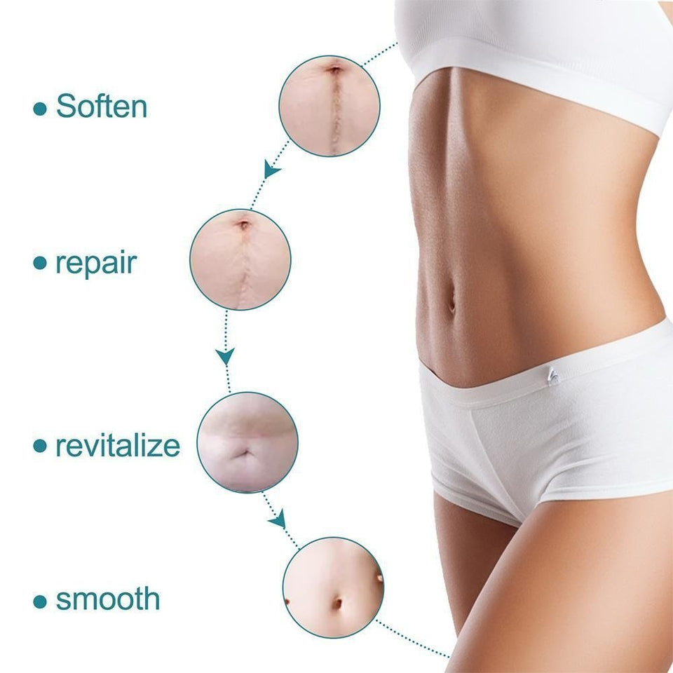 ELAIMEI™ Medical Soft Silicone Gel Tape for Scar Removal (1.6” x 60”） - TumTum