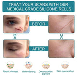 ELAIMEI™ Medical Soft Silicone Gel Tape for Scar Removal (1.6” x 60”） - TumTum