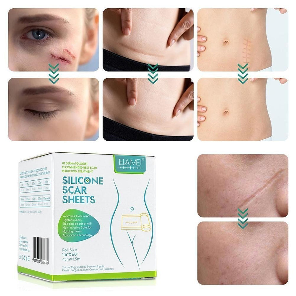 ELAIMEI™ Medical Soft Silicone Gel Tape for Scar Removal (1.6” x 60”） - TumTum