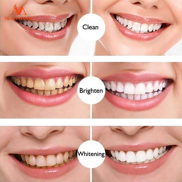 HeySmile ™ - Teeth Whitening Pen - TumTum