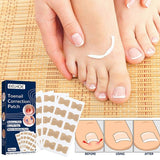 NailFixer™ - Toenail Paronychia Corrector (50 Pcs ) - TumTum