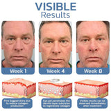 PeptiGel ™ - Eye Lift Cream - TumTum