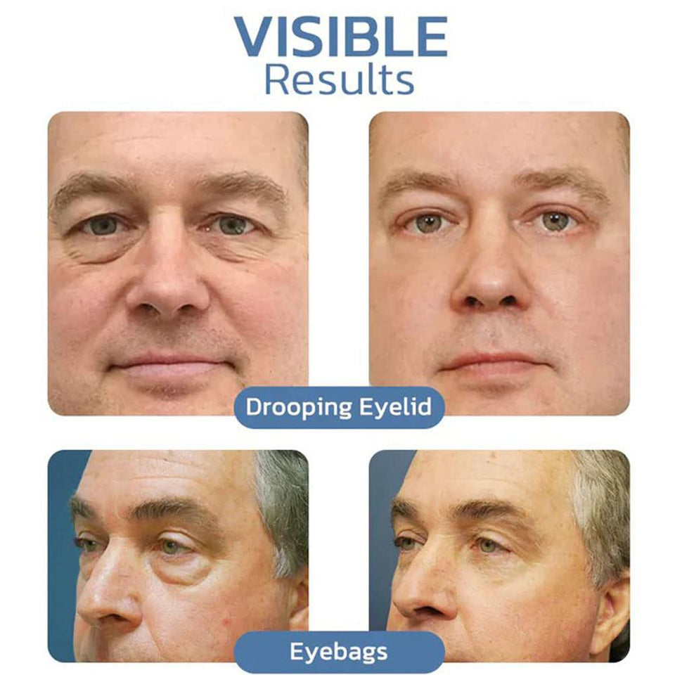 PeptiGel ™ - Eye Lift Cream - TumTum