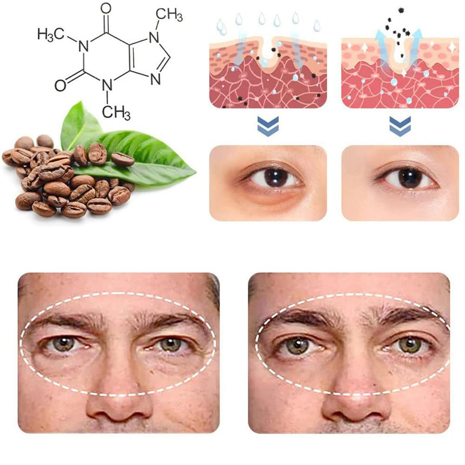 PeptiGel ™ - Eye Lift Cream - TumTum