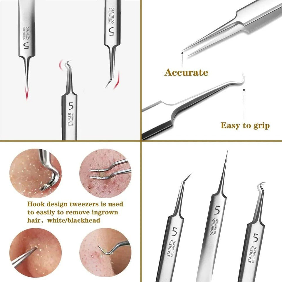 PimplesAway™ - Blackhead Remover Tweezer Kit - TumTum