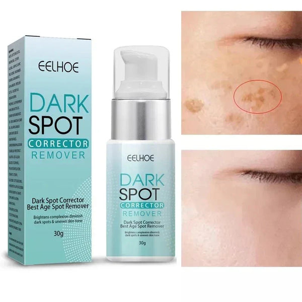 TumTum ™ - Dark Spot Corrector Remover - TumTum