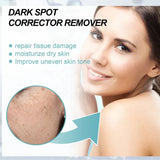TumTum ™ - Dark Spot Corrector Remover - TumTum