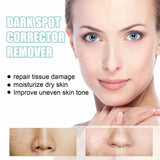 TumTum ™ - Dark Spot Corrector Remover - TumTum