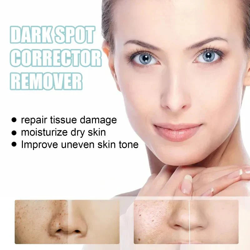 TumTum ™ - Dark Spot Corrector Remover - TumTum