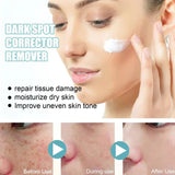 TumTum ™ - Dark Spot Corrector Remover - TumTum