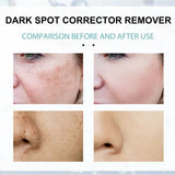 TumTum ™ - Dark Spot Corrector Remover - TumTum